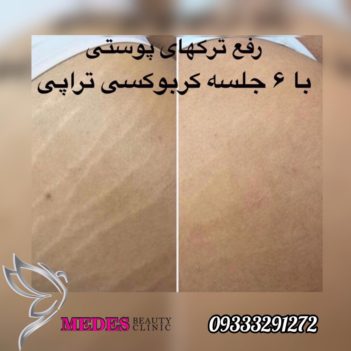 گالری کربوکسی تراپی
